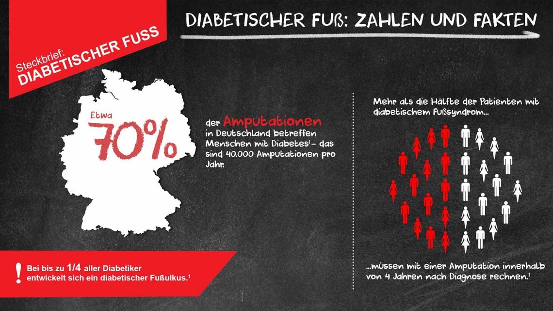 Diabetischer Fuß: Daten & Fakten